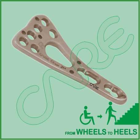 Locking Plate Volar Column Distal Radius 2.4/2.7mm 6 Hole Head, Right ...